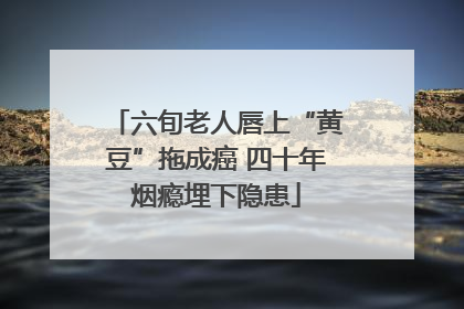 六旬老人唇上“黄豆”拖成癌 四十年烟瘾埋下隐患